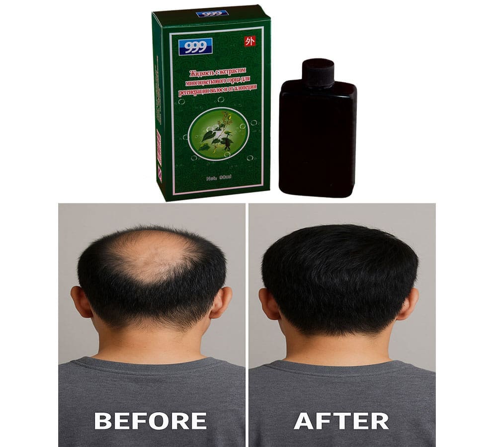 🧴 999 Élixir de Croissance (Original) – Image 2